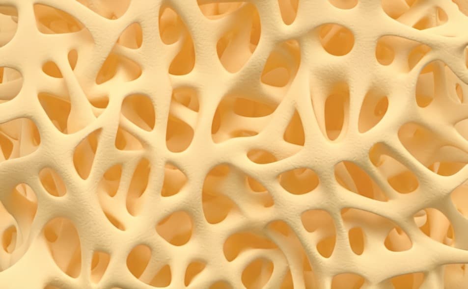 Osteoporoz: Bilmeniz Gereken Her Şey - Doktorify