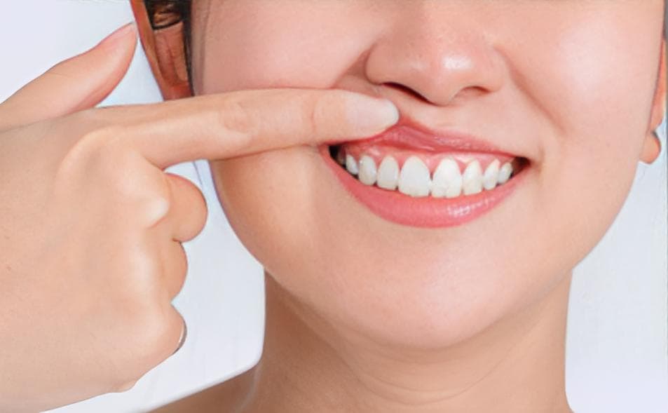 Periodontoloji Nedir? Periodontolog ne yapar?